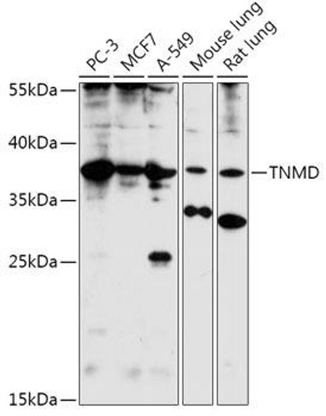 TNMD Rabbit Polyclonal Antibody (CAB17753)