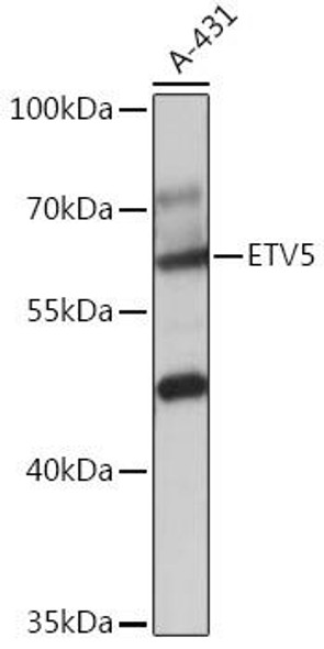 ETV5 Rabbit Polyclonal Antibody (CAB17927)