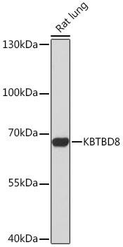 Cell Biology Antibodies 17 Anti-KBTBD8 Antibody CAB18513