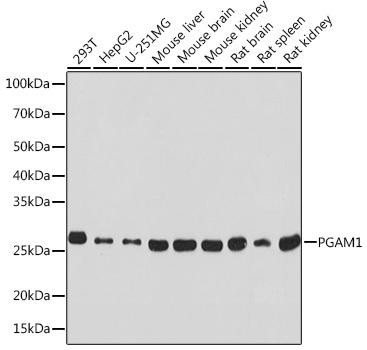 PGAM1 Rabbit Monoclonal Antibody (CAB4170)