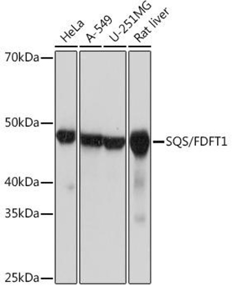 SQS/FDFT1 Rabbit Monoclonal Antibody (CAB4651)