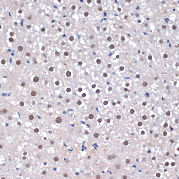SRRT Rabbit Polyclonal Antibody (CAB8219)