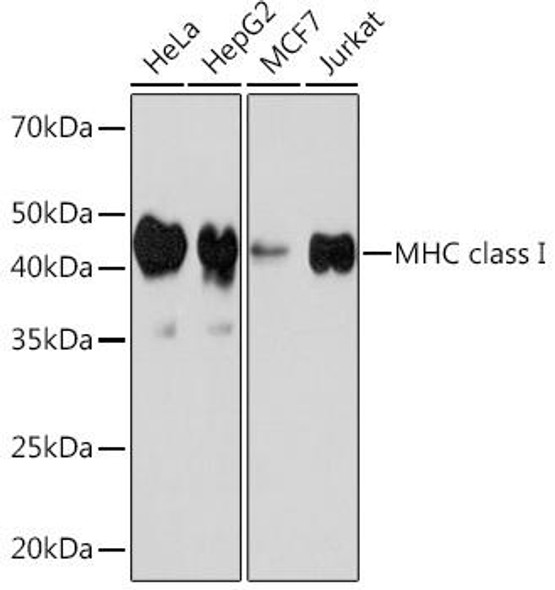 MHC class I (HLA-A/B) Rabbit Monoclonal Antibody (CAB8754)