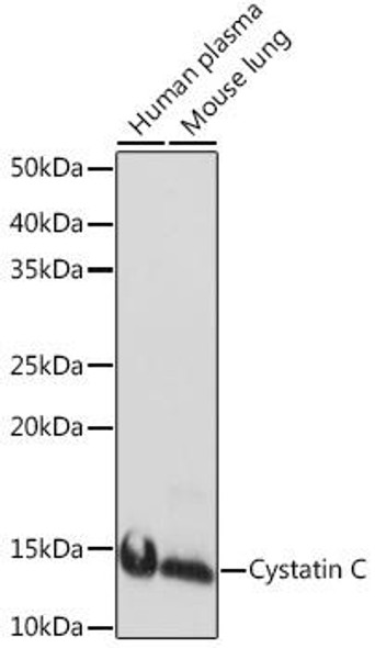 Cystatin C Rabbit Monoclonal Antibody (CAB8933)