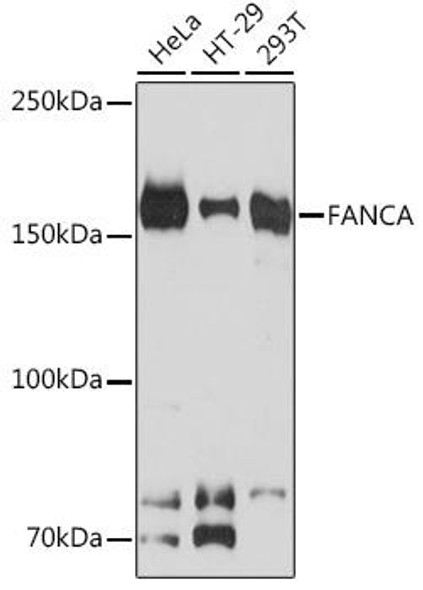 FANCA Rabbit Monoclonal Antibody (CAB9529)