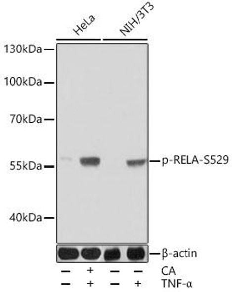 Phospho-NF-kB p65/RelA-S529 Rabbit Polyclonal Antibody (CABP0944)
