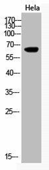 Acetyl-KRT (K194) Antibody (PACO00070)