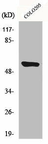 CYP4A11/CYP4A22 Antibody (PACO00670)