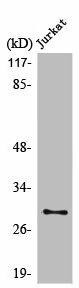 LDLRAD2 Antibody (PACO01019)