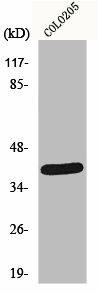 NEGR1 Antibody (PACO01152)