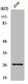 TSPAN9 Antibody (PACO01156)