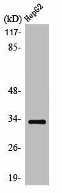 SLC25A21 Antibody (PACO01200)