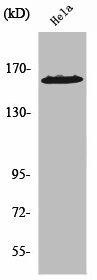 ZNF608 Antibody (PACO01731)