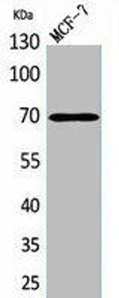 HSPA1A Antibody (PACO02105)