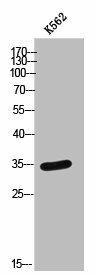 PTGR2 Antibody (PACO02495)
