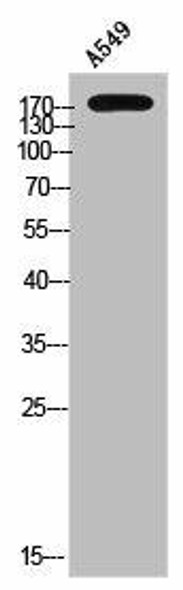 Phospho-SGK223 (Y413) Antibody (PACO02543)