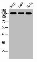 GPR158 Antibody (PACO03043)