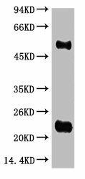 Anti-IgG (H+L) Antibody (MACO0123)