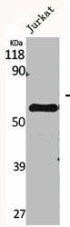 CYP2A7 Antibody (PACO06399)