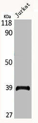 MRPL3 Antibody (PACO06654)
