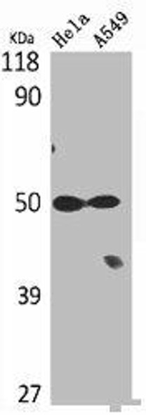 TUBA1A/TUBA1B Antibody (PACO07151)
