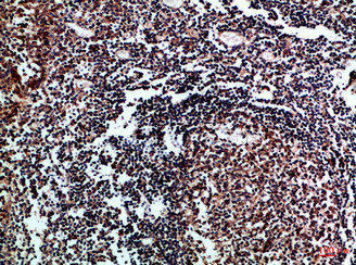 IL17D Antibody (PACO07421)