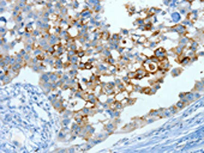 MUC15 Antibody (PACO14075)