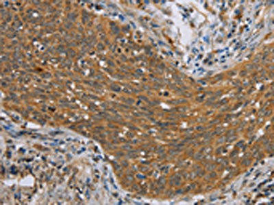 ADAMTS15 Antibody (PACO14105)