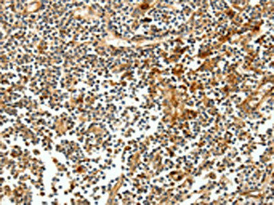 CEACAM21 Antibody (PACO14237)