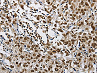 CMTM2 Antibody (PACO14251)