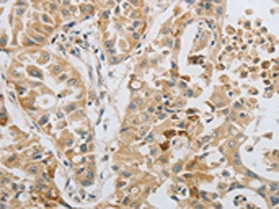 MAGEB4 Antibody (PACO14673)