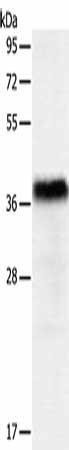 PGBD2 Antibody (PACO15204)