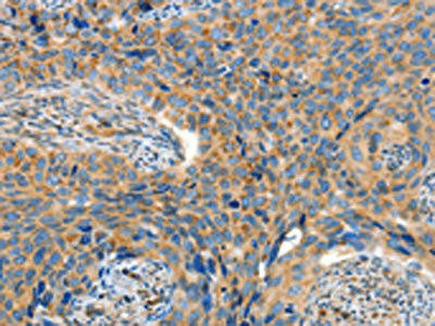 ADAMTS18 Antibody (PACO15316)