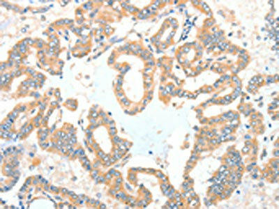 ADCK1 Antibody (PACO15320)