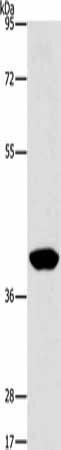 PHYKPL Antibody (PACO15355)