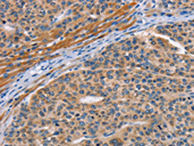 ALG12 Antibody (PACO15385)