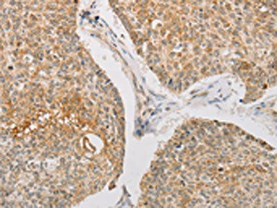 STK40 Antibody (PACO15680)