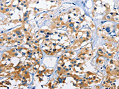 CAPZA3 Antibody (PACO15924)