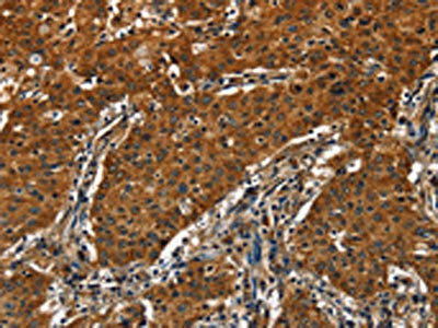 CATSPER4 Antibody (PACO15939)
