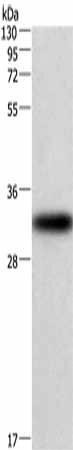 CENPP Antibody (PACO16004)