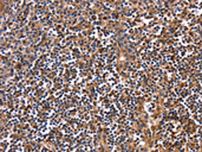 CLUAP1 Antibody (PACO16047)