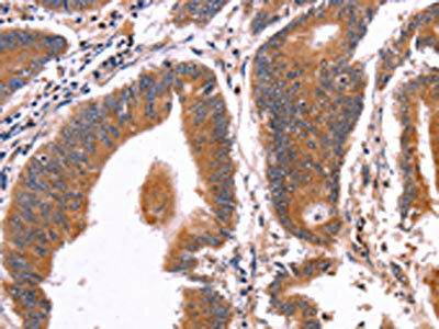 CRISP3 Antibody (PACO16074)