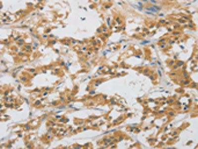 DDIT4L Antibody (PACO16165)