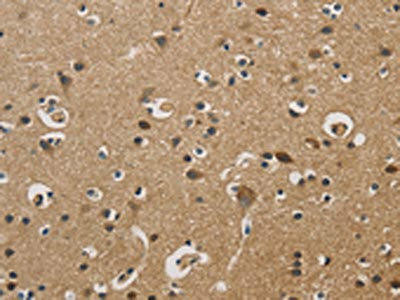 DUSP23 Antibody (PACO16208)