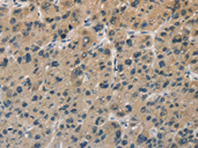 DUSP26 Antibody (PACO16211)