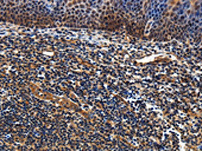 LRRC57 Antibody (PACO16632)
