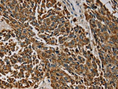 CMC4 Antibody (PACO16711)