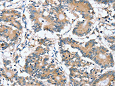 PLCZ1 Antibody (PACO16875)