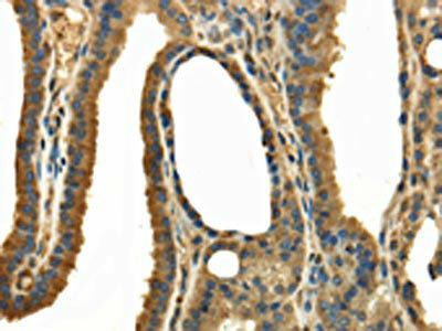 TRPC4AP Antibody (PACO17326)