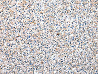 TXNDC11 Antibody (PACO17346)